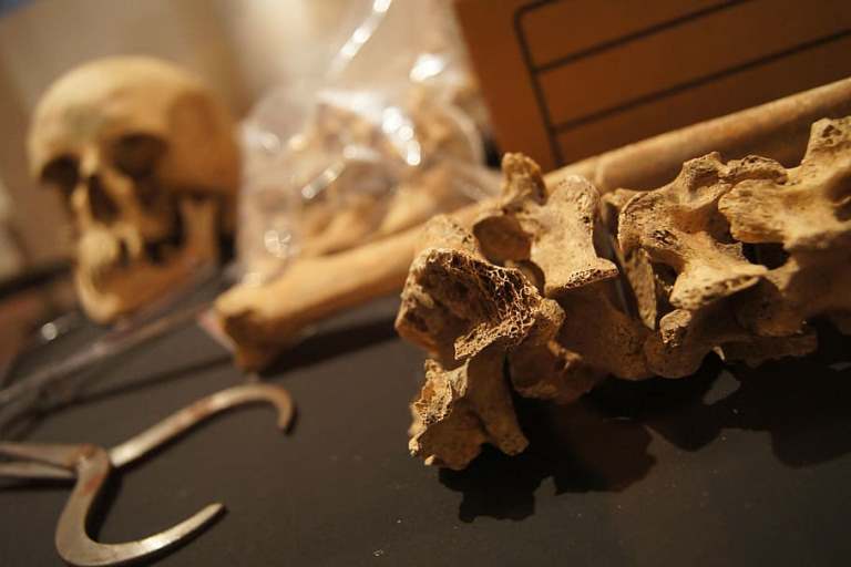 bones-skull-death-museum.jpg